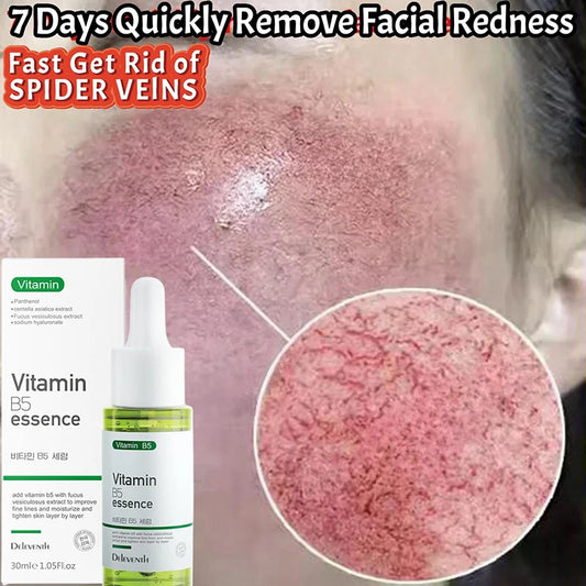 Repair Facial Redness Serum Instant Spider Vein Remove Sensitive Skin Sooth Anti Redness Rosacea Treat Lotion Korean Cosmetics - Jamboshop.com