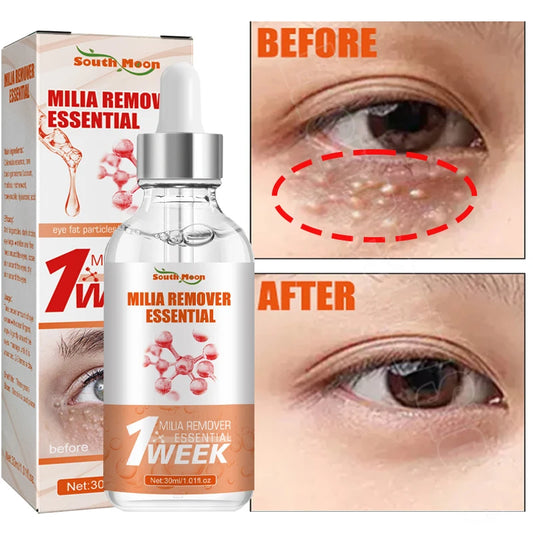 Fat Granules Removal Eye Serum Eye Milia Repair Treatment Products Wrinkle Lifting Moisturizing Anti-Puffiness Korean Skin Care - Jamboshop.com
