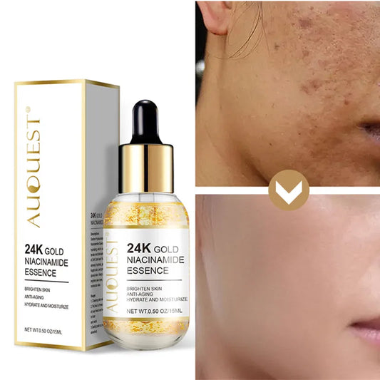 24k Gold Facial Serum Niacinamide Face Serum Dark Spots Remover Hyaluronic Acid Fade Fine Lines Moisturizing Whitening Skin Care - Jamboshop.com